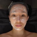 엠제이(MJ)헬스케어 | 관리Day - v&amp;mj피부과, 울쎄라, 히트업써마지