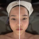 (주)브이써클메디칼 | 성신여대피부관리 MK 엠케이에스테틱 : 기계와 수기관리의 조화, 즉각적인 브이라인 리프팅 후기