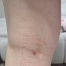 장미꽃과나이팅게일외과의원 이미지