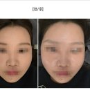 코지스킨케어 | 광주 쌍촌동 피부관리 르헤브 스킨케어 LDM후기