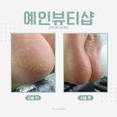 창원 패디플래닝 상남동 예인뷰티샵 여름철 필수 발각질제거
