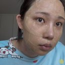 연세보드미의원 네이버블로그