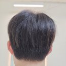 모모즈헤어&증모