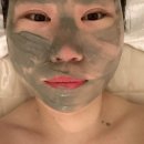 원주무실동이중턱관리 잘하는 곳 이코웨이브에스테틱에서 하이푸 후기