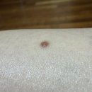 피브로한의원 이미지