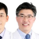 김 콘택트렌즈 이미지