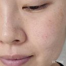 모공&amp;피지관리 꿀템 블랙헤드 없애는 법 👉 셀로라바이 멀티투폼 클렌저 &amp; 모공리무버 세럼 내돈내산...