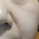 금곡프라자 약국 | 쥬비렉스 올리고 약국화장품 PDRN크림으로 겉촉속촉