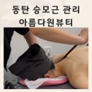 동탄어깨관리 동탄승모근집중관리 아름다원뷰티 비포애프터후기
