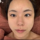 분당야탑3-A-7 | 분당 얼굴 윤곽관리 추천, '빛나는 지금 야탑점' 10회차 내돈내산 솔직 후기