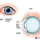 눈 실핏줄 터짐 눈 이물감 한쪽 눈충혈 원인 예방 이미지