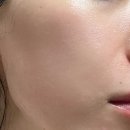 대웅약국 | 대웅 EGF 새살연고 재생크림 병행 후기