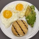최고안과의원 | [👀]스마일라식 수술 3년차 내돈내산 후기, 강남 눈에미소 안과의원