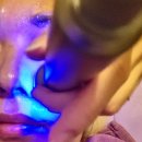 (주) 더블제이게임즈 | 구리역 피부과 보톡스 리투오 시술 12일 경과 내돈내산 후기 에비뉴제이 추천