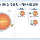 세계로안경 이미지