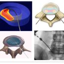 피티메이저 이미지