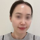 피부정화스킨&바디 | 수완지구 피부관리 한별스킨바디 4회차 US관리 후기(feat.7월 이벤트 낭낭쓰)