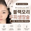 m헤어 | [금천/가산] 금천구탈모 &amp; 두피 관리 모백 생장술[블랙모리] M자 헤어라인 관리 방문후기