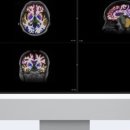 뉴로핏(주) 이미지