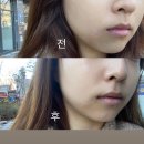 아담&이브 | 대구피부관리 수성구에스테틱 아담앤이브 범물점 재생케어 고주파관리 후기