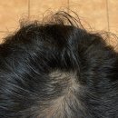 남자탈모긴급상황 도움의 손길이 필요한 시간입니다 토탈탈모교정펌 탈모교정커버펌과두피에묻지않는염색콜라보/ 사상감전김해모라하단개금서면부전부암 이미지