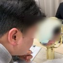 새하늘약국 | 서면 피부과 편평사마귀 레이저 한달차 내돈내산 후기