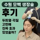 [수원] 모백(mo100) 생장술 후기. 두피열·각질 고민에 진짜 효과 있었을까?