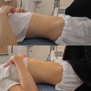 [의정부 통증관리] 누보레브 미세전류 복부관리 솔직 후기, 복부관리 효과와 다이어트 추천!
