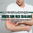 카톨릭피부과 네이버블로그