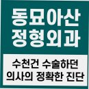 [동묘아산정형외과] 정형외과 재활치료, 언제 필요할까요? 이미지