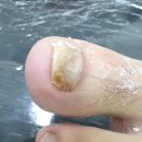 레푸스 앤 두두네일 이미지