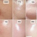 인셀덤발라또그룹