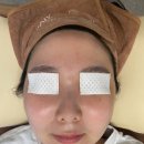 홀리엘뷰티(Holy el beauty) | 대구 심각한문제성피부 전문 피부관리샵 홀리엘뷰티에스테틱