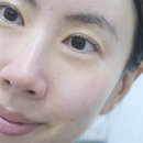 바로웰병원 | 일본 질염 유산균 메타웰 치세이아 1개월 먹어본 솔직후기