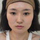 뷰리플한의원 | 내돈내산 안면비대칭교정 뷰리플한의원 방문 솔직후기