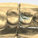 하이브치과기공소 이미지