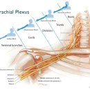 상완신경총 손상(Brachial Plexus Injuries) 이미지