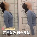 김호수전문전신관리 | 마곡바디관리 근본림가 비대칭 전문 전신체형관리 2시간 후기