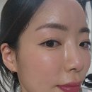 다은메디칼 | 서울대입구 봉천 ㅣ 피부관리 에스테틱다은 플라즈마 후기 여름맞이 모공·진정관리