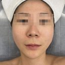 마산피부관리 추천. 석전동 헤이미(HEYME) 모공관리 꼼꼼하게 하는곳