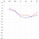 순음보청기 이미지