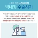 아이준안과 이미지