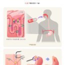 위 이미지