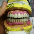 RPD치과기공소 이미지