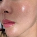 안산에스테틱 민뷰티 스킨플래닝 써마지 피부관리 후기