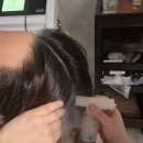 나영통뷰티센터 | 영통 두피관리 WT메소드 수원영통점｜탈모 스페셜 프로그램 후기