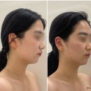여울소리 | 대전 윤곽관리 스파여울 대전 유성점, 시그니처 벨라인 윤곽관리 추천