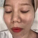 화서점 기아오토큐 | [화서동 피부관리] “반달뷰티 BROW &amp; SKIN”에서 여드름관리 솔직리뷰