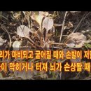 팔다리가 마비되고 굳어질 때와 손발이 저릴때, 혈관이 막히거나 터져 뇌가 손상될 때 사용하면 좋은 이것은 이미지