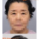 에스에이치(SH)성형외과의원 이미지